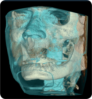 soft_tissue_xray[1]